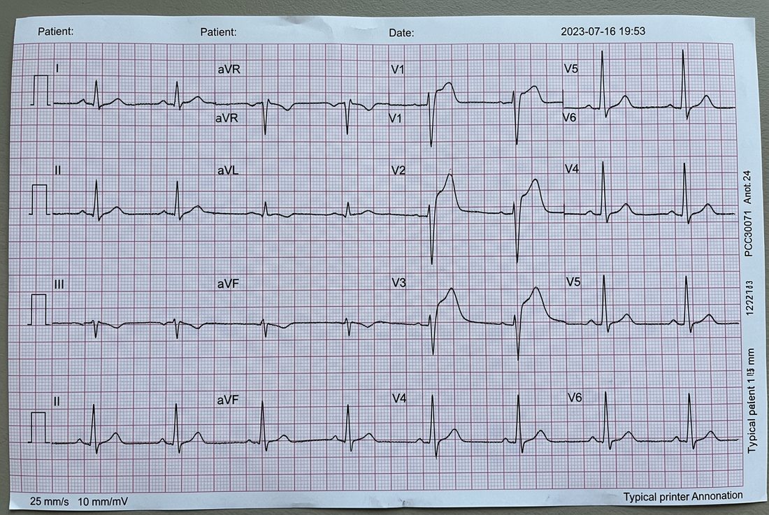 Twelve-lead electrocardiogram