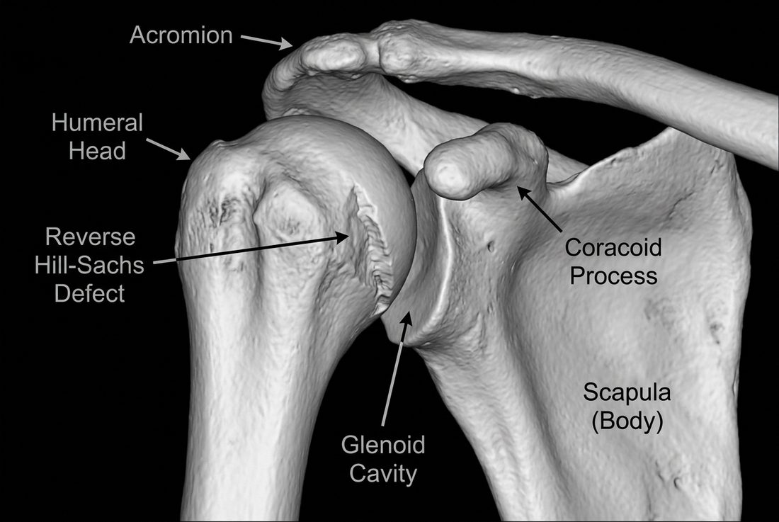 Three-dimensional CT reconstruction